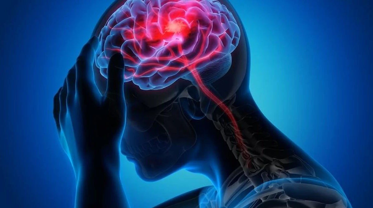 Migren Belirtileri Nedenleri Ve Tedavi Yöntemleri